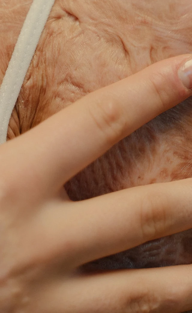 Burn injury claim advice