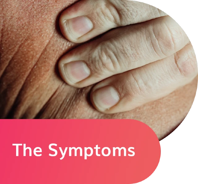 Symptoms of a whiplsh injury