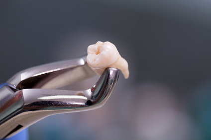 Dental injury compensation claims