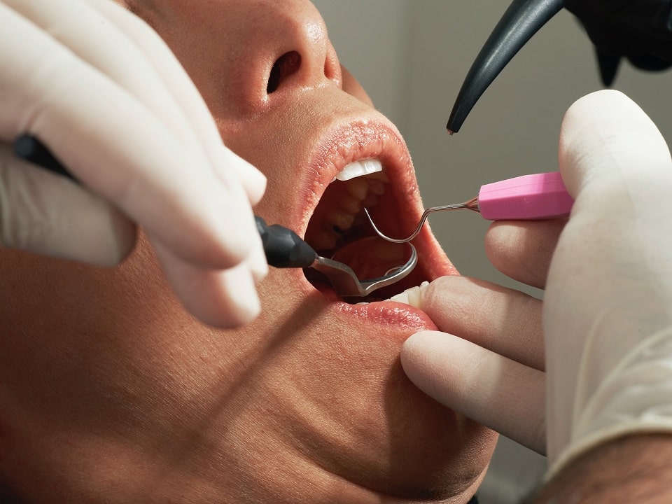 dental negligence case