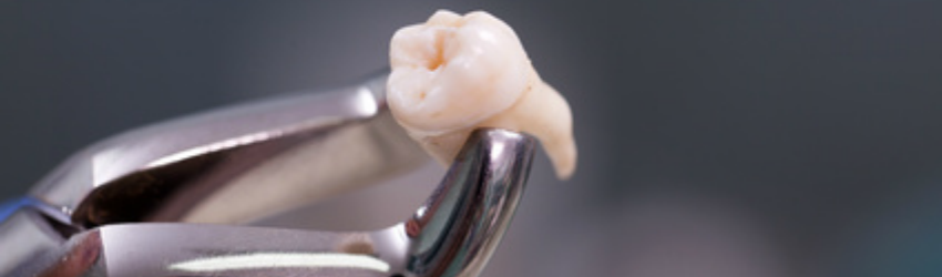 advice for dental injury claims
